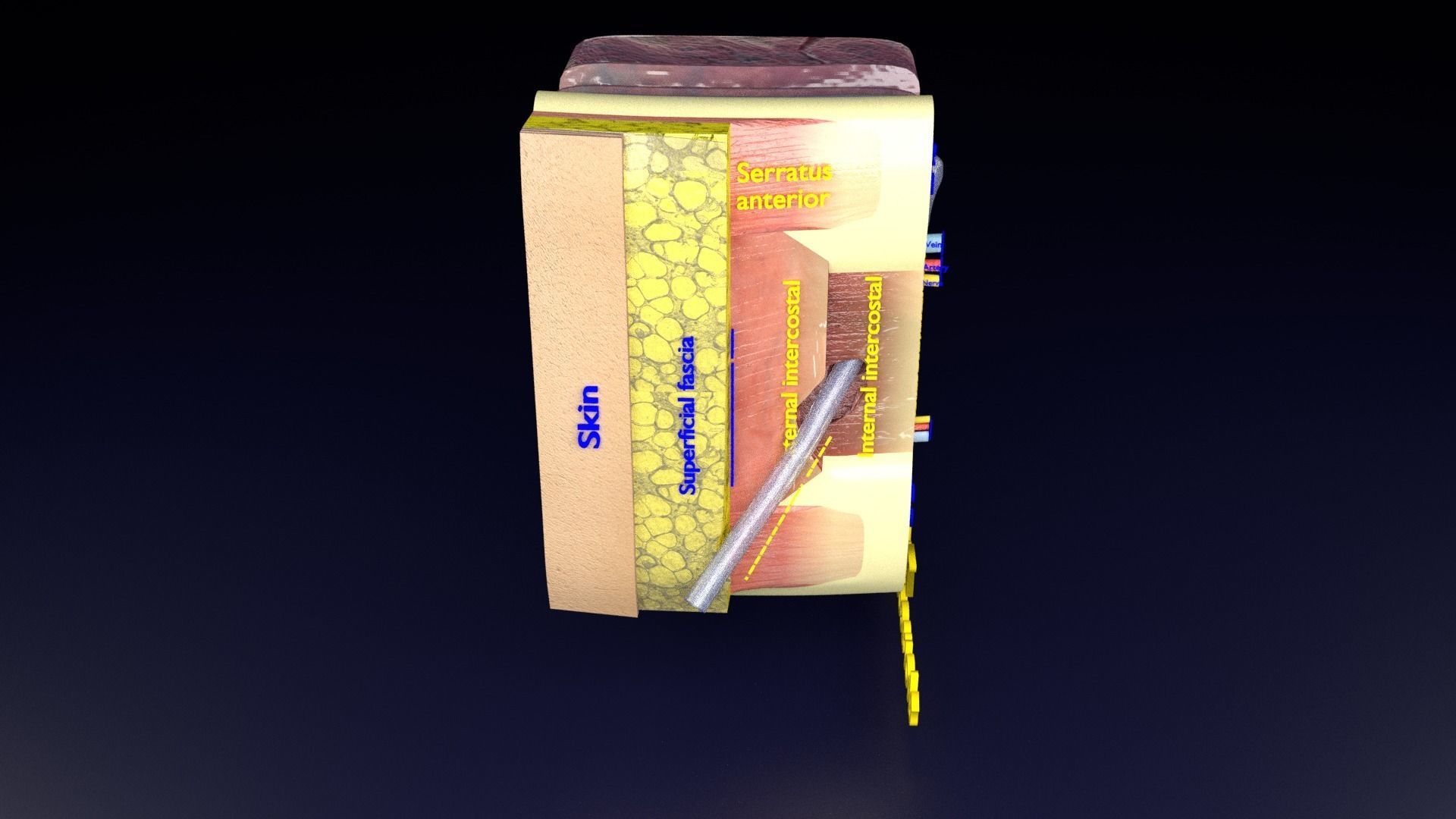 thorax thoracotomy thoracocentesis intercostal nerve block 3D model_55