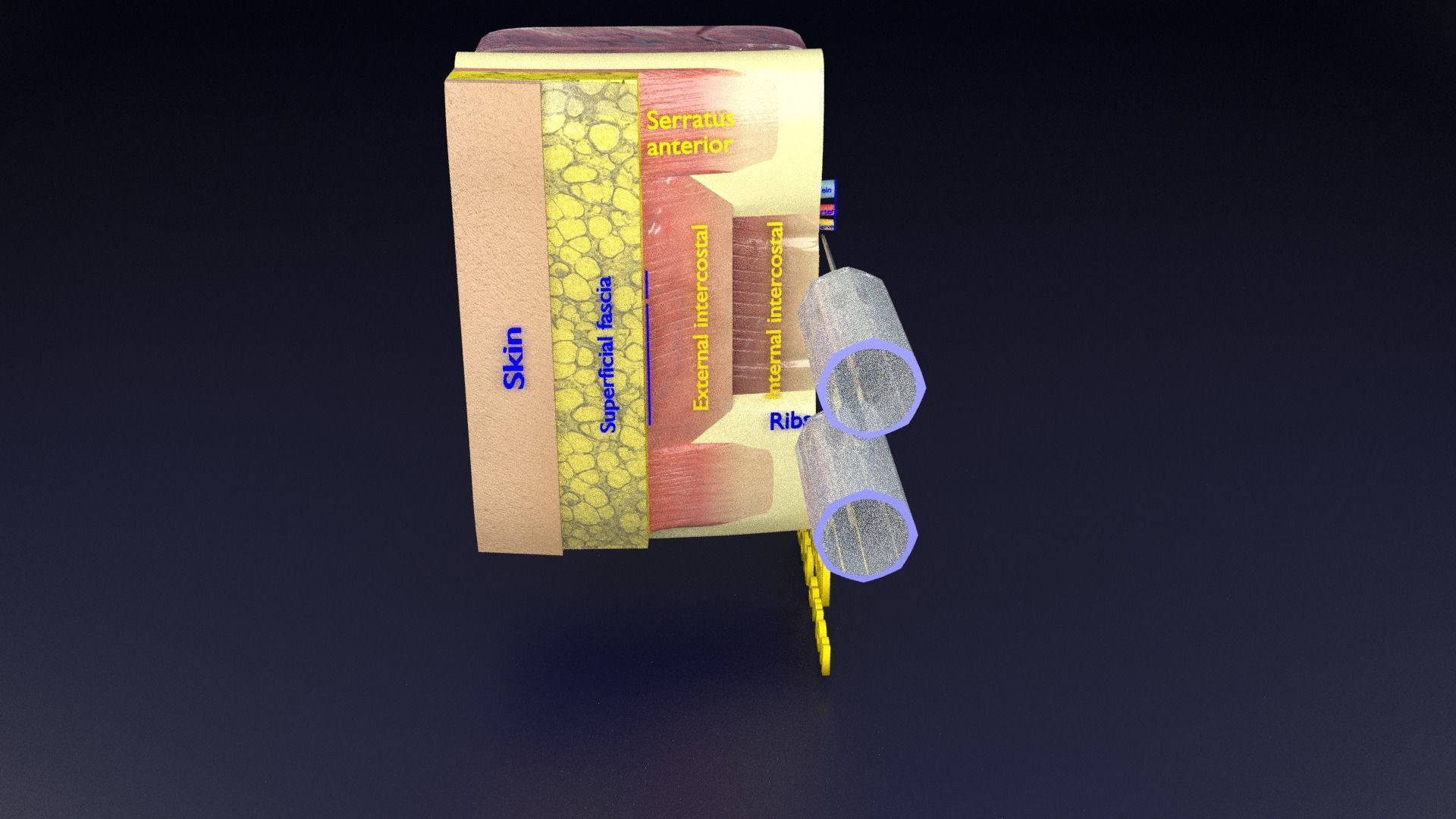 thorax thoracotomy thoracocentesis intercostal nerve block 3D model_96