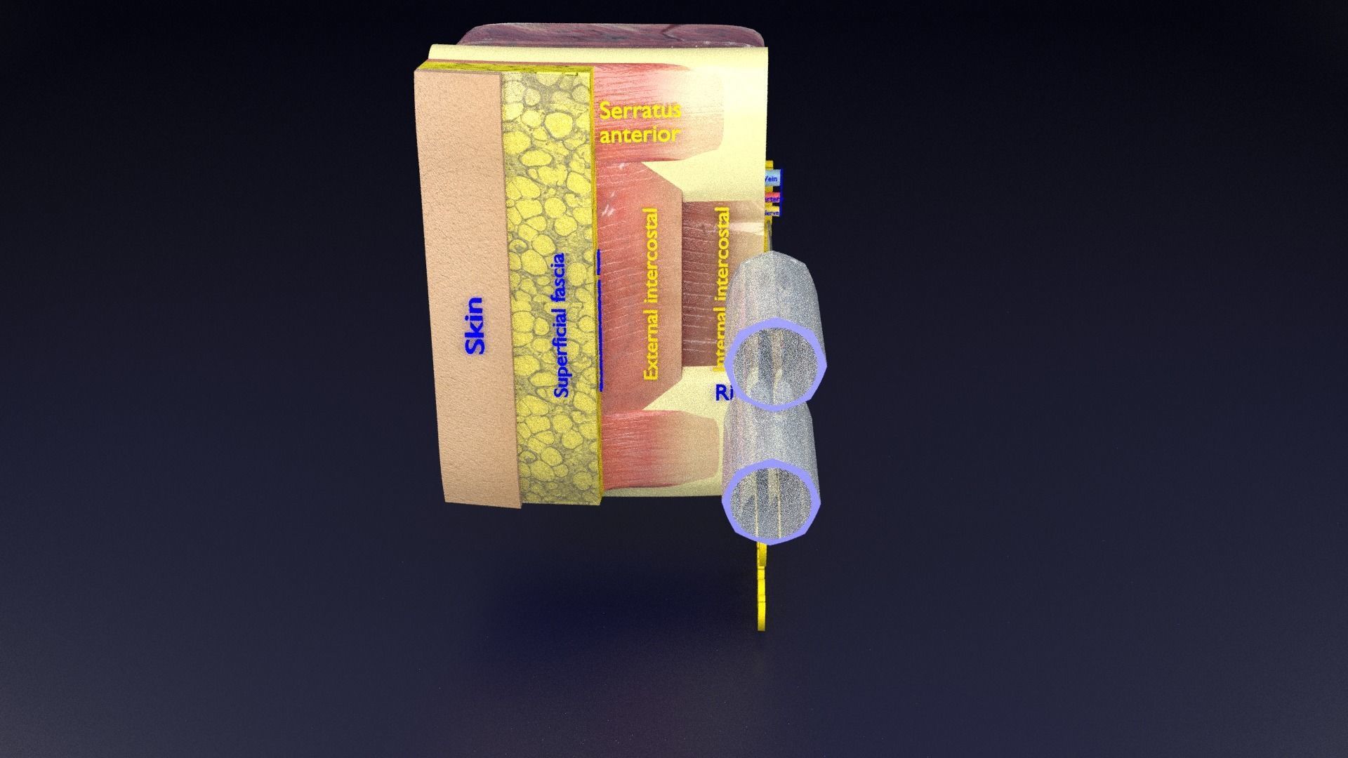 thorax thoracotomy thoracocentesis intercostal nerve block 3D model_92