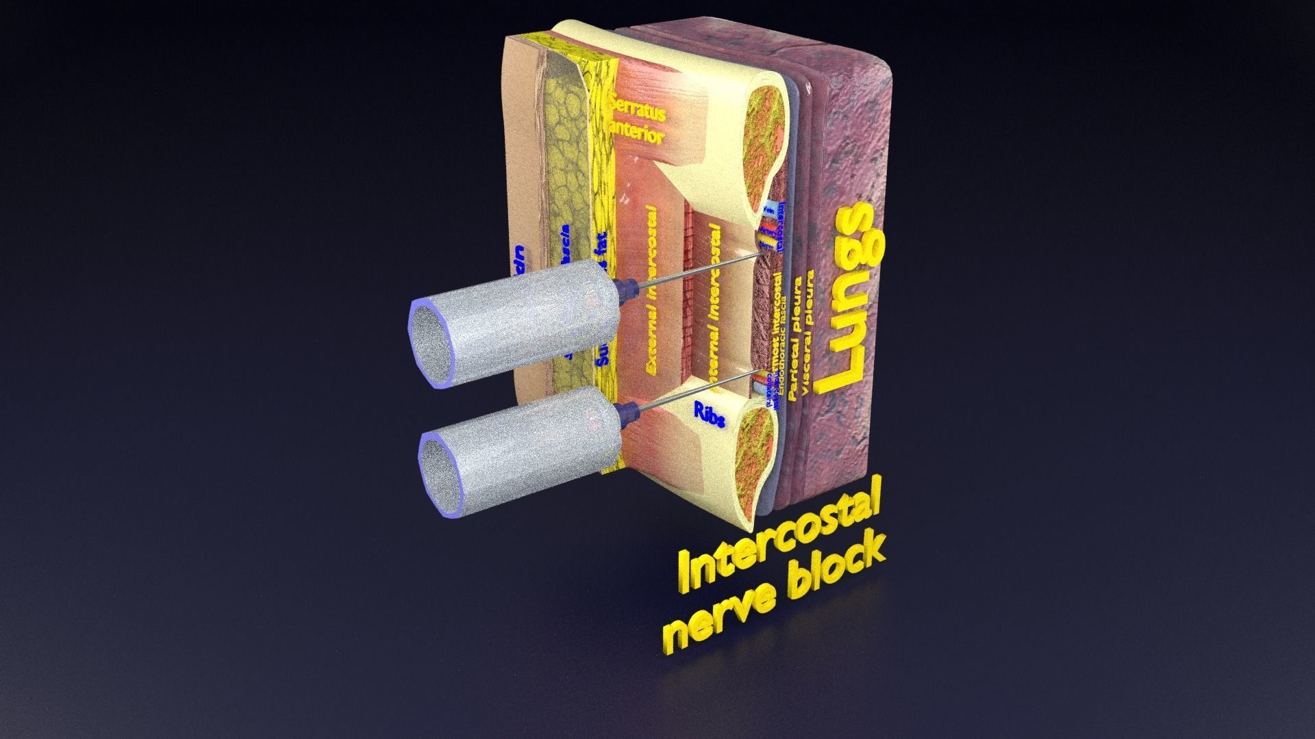 thorax thoracotomy thoracocentesis intercostal nerve block 3D model_94