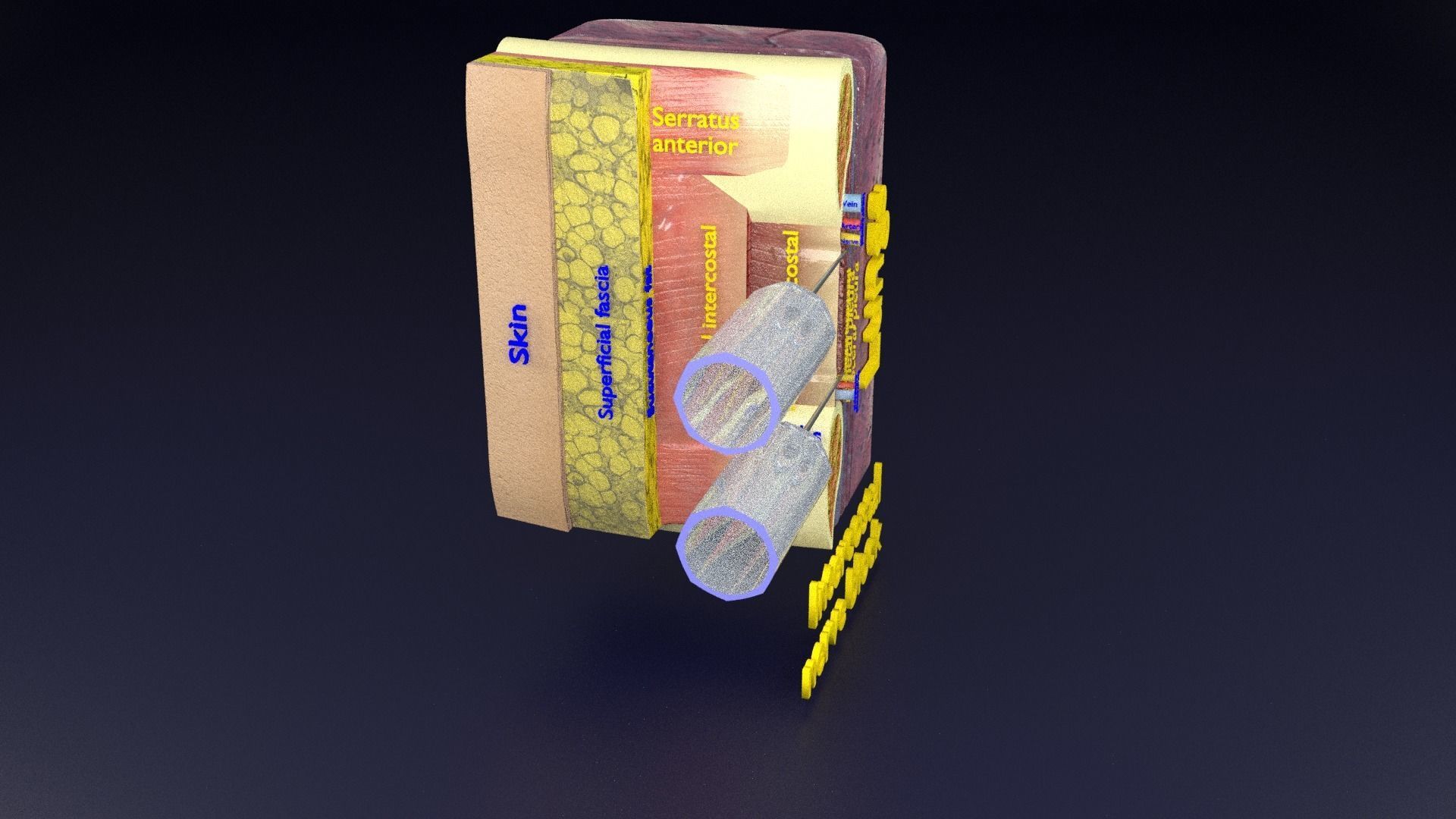 thorax thoracotomy thoracocentesis intercostal nerve block 3D model_84