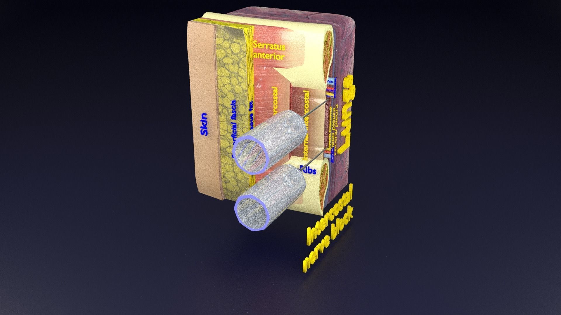 thorax thoracotomy thoracocentesis intercostal nerve block 3D model_78