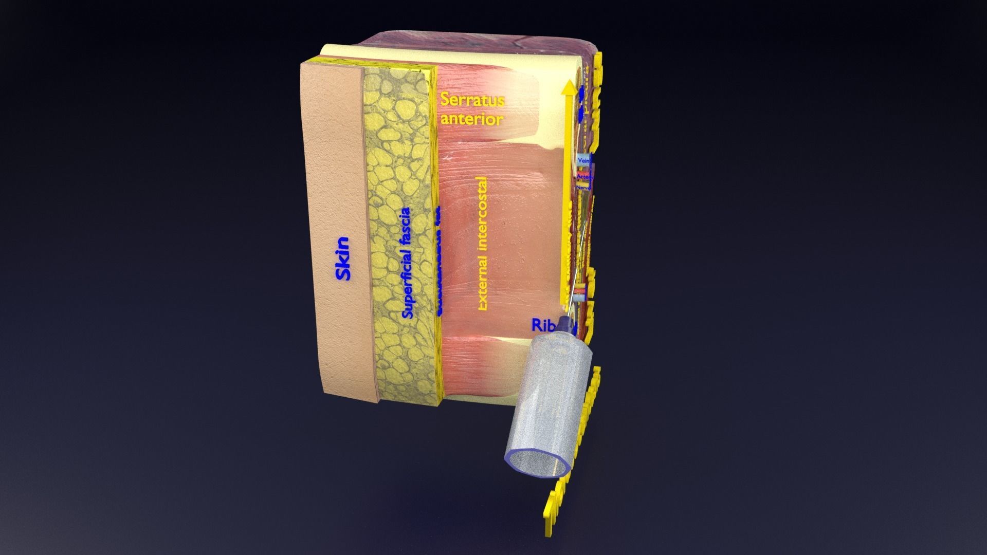 thorax thoracotomy thoracocentesis intercostal nerve block 3D model_81