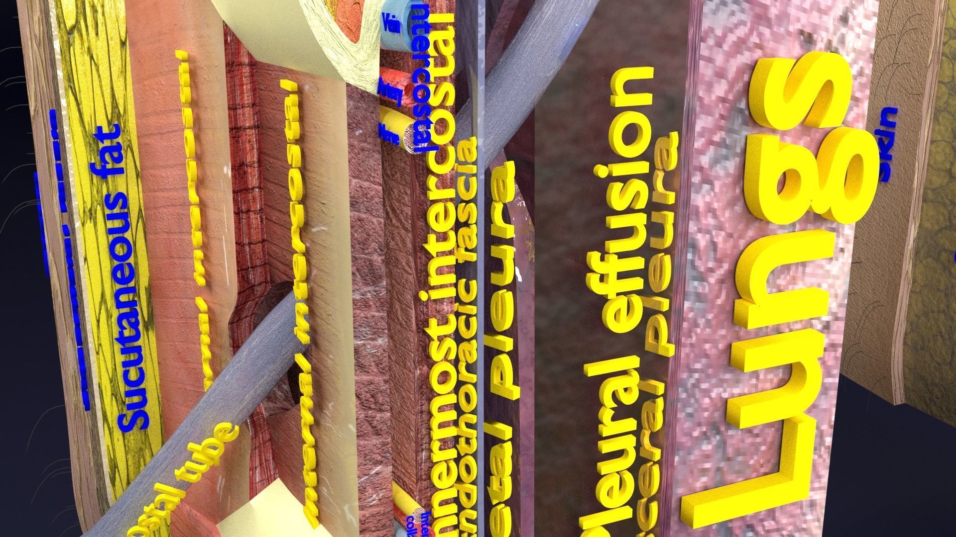 thorax thoracotomy thoracocentesis intercostal nerve block 3D model_33