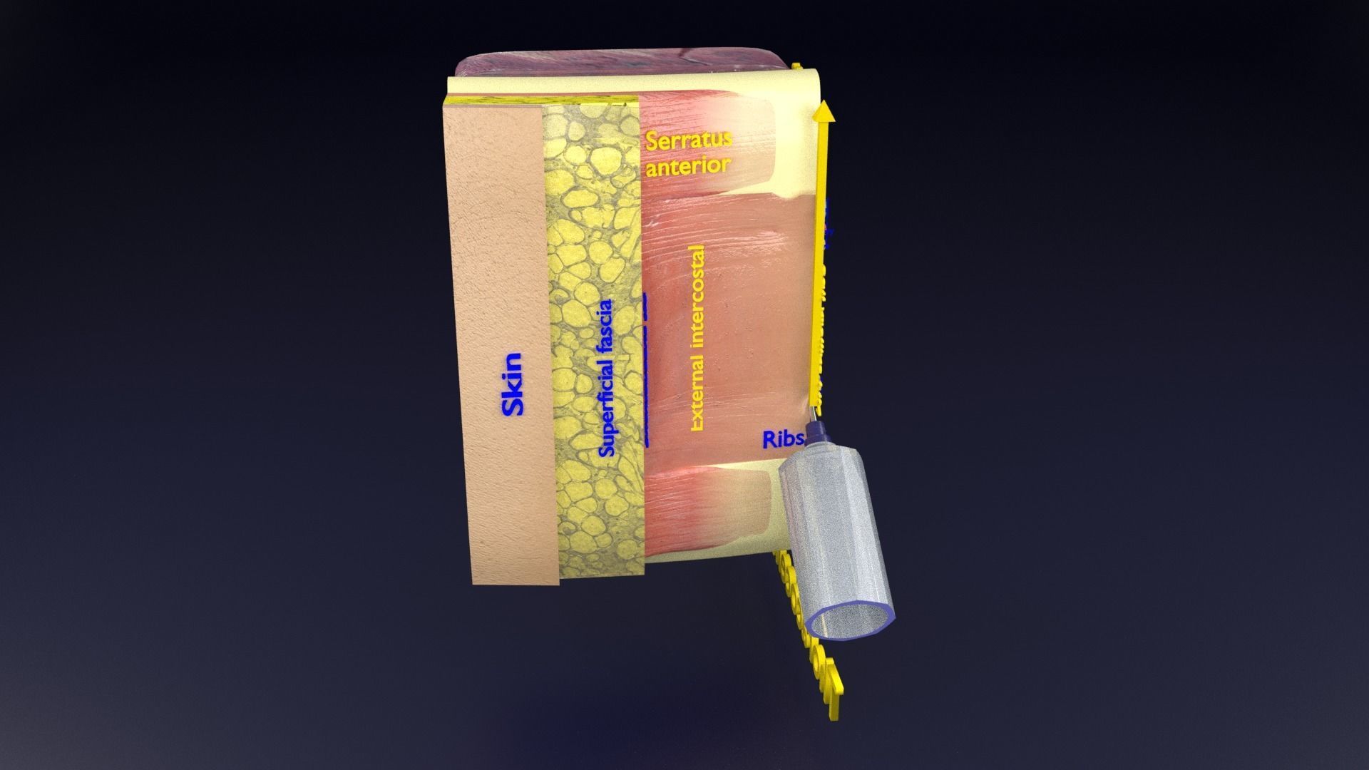 thorax thoracotomy thoracocentesis intercostal nerve block 3D model_68