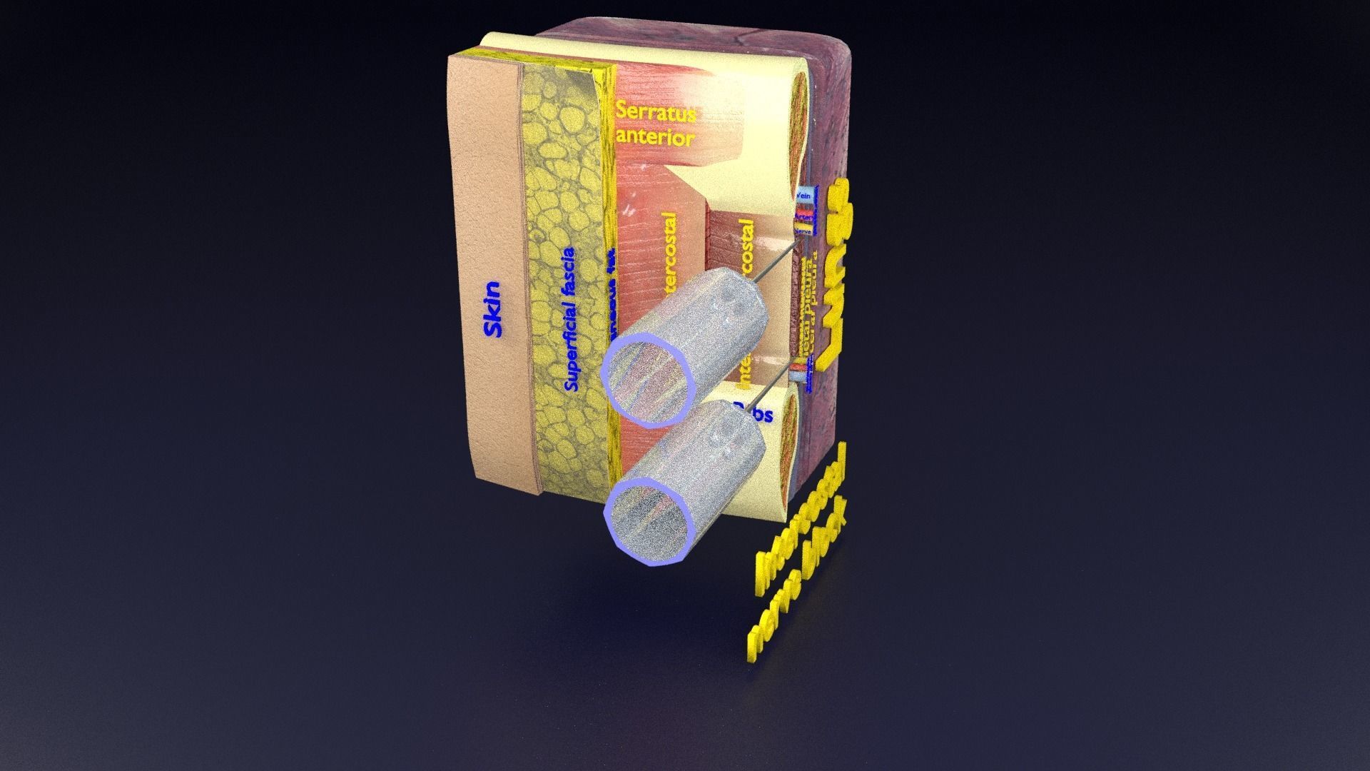 thorax thoracotomy thoracocentesis intercostal nerve block 3D model_79