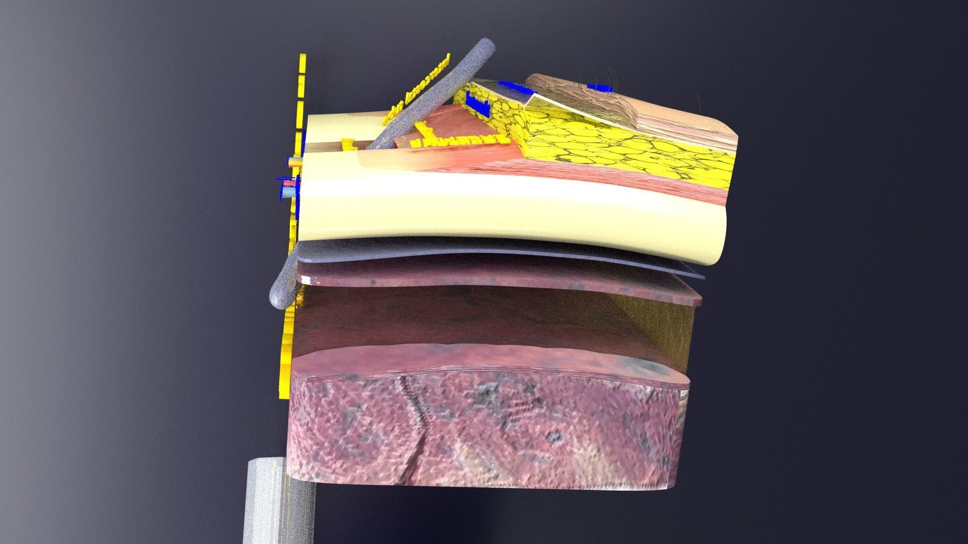 thorax thoracotomy thoracocentesis intercostal nerve block 3D model_37