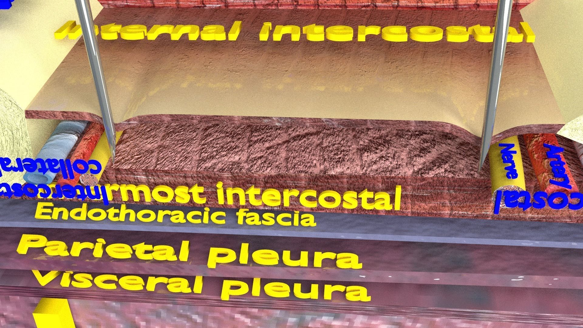 thorax thoracotomy thoracocentesis intercostal nerve block 3D model_28