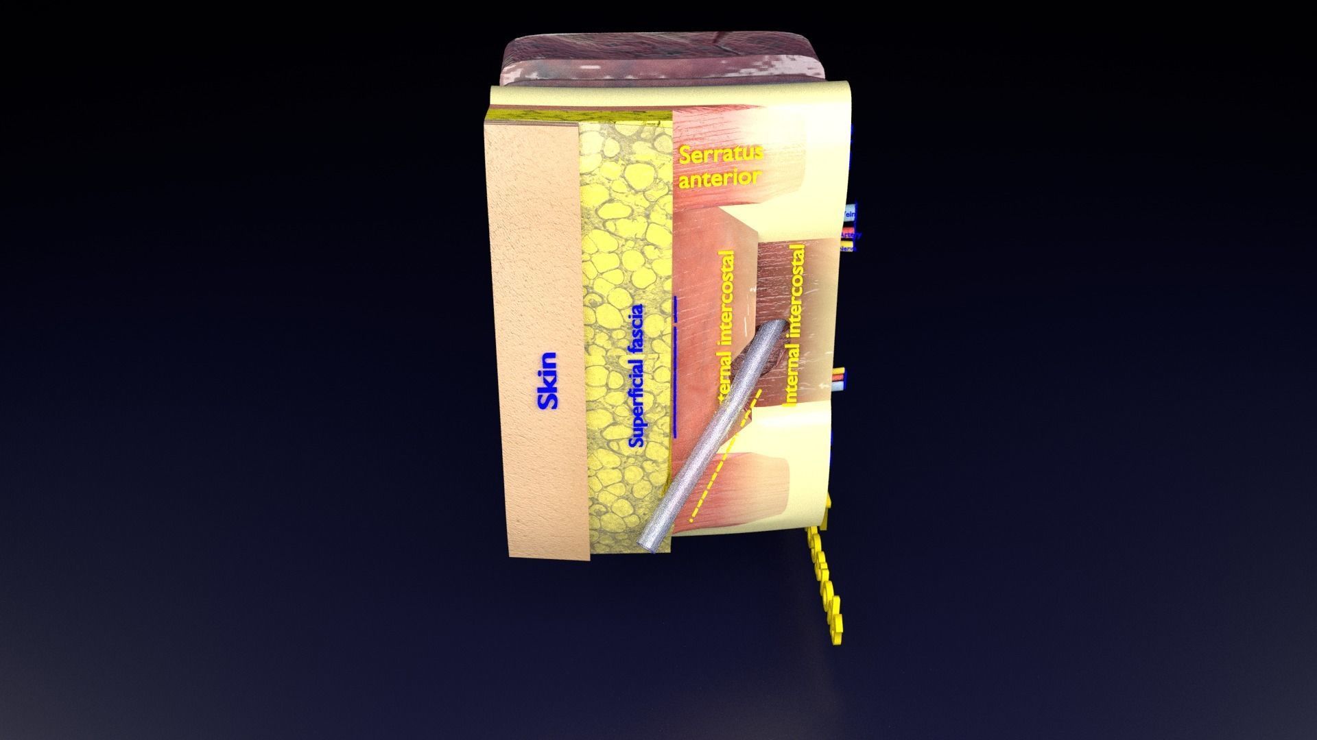 thorax thoracotomy thoracocentesis intercostal nerve block 3D model_51