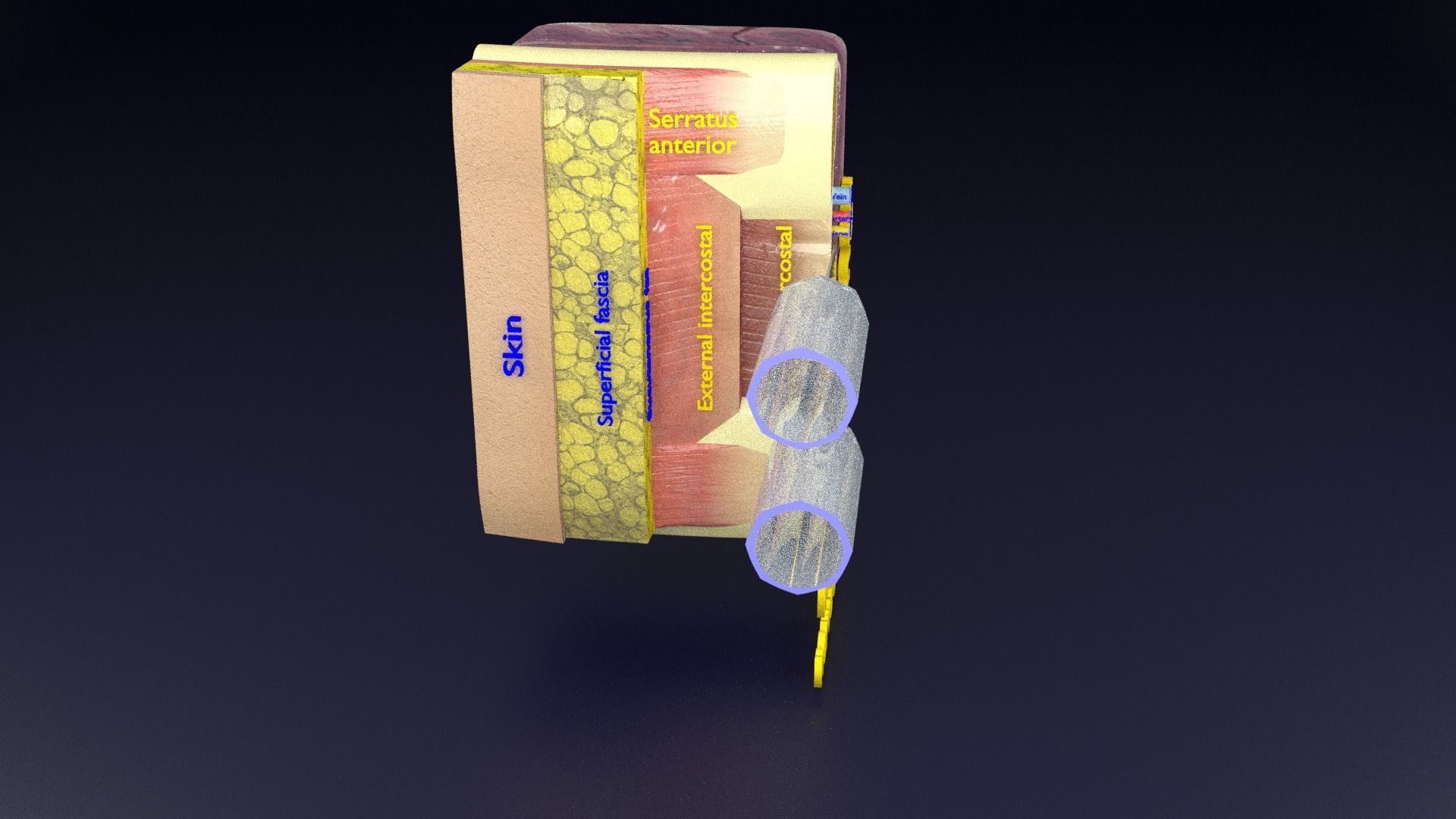 thorax thoracotomy thoracocentesis intercostal nerve block 3D model_93