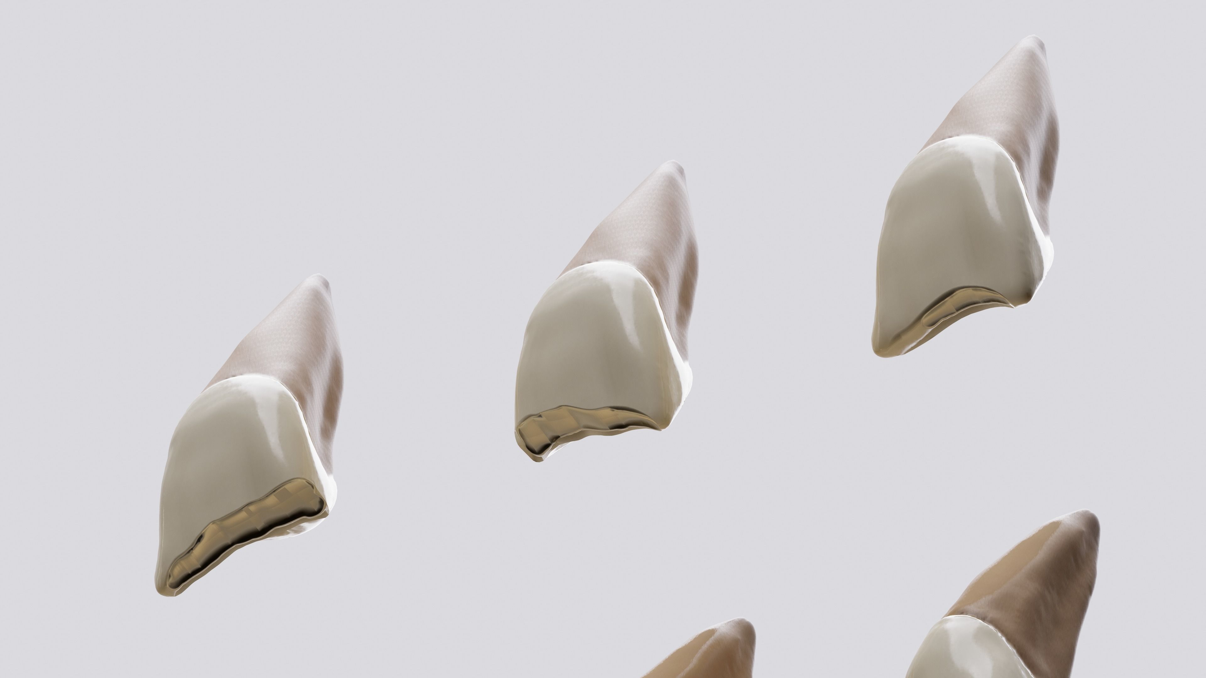 Permanent Teeth class 4 Caries 3D model_3