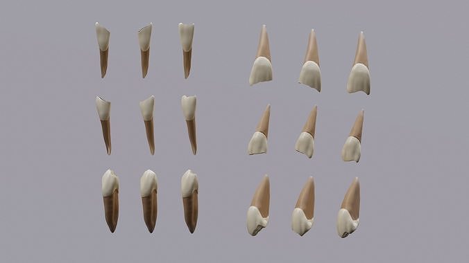 Permanent Teeth class 4 Caries 3D model