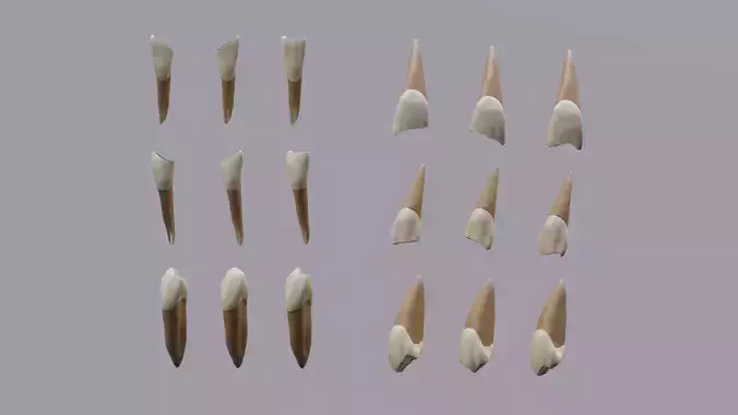 Permanent Teeth class 4 Caries