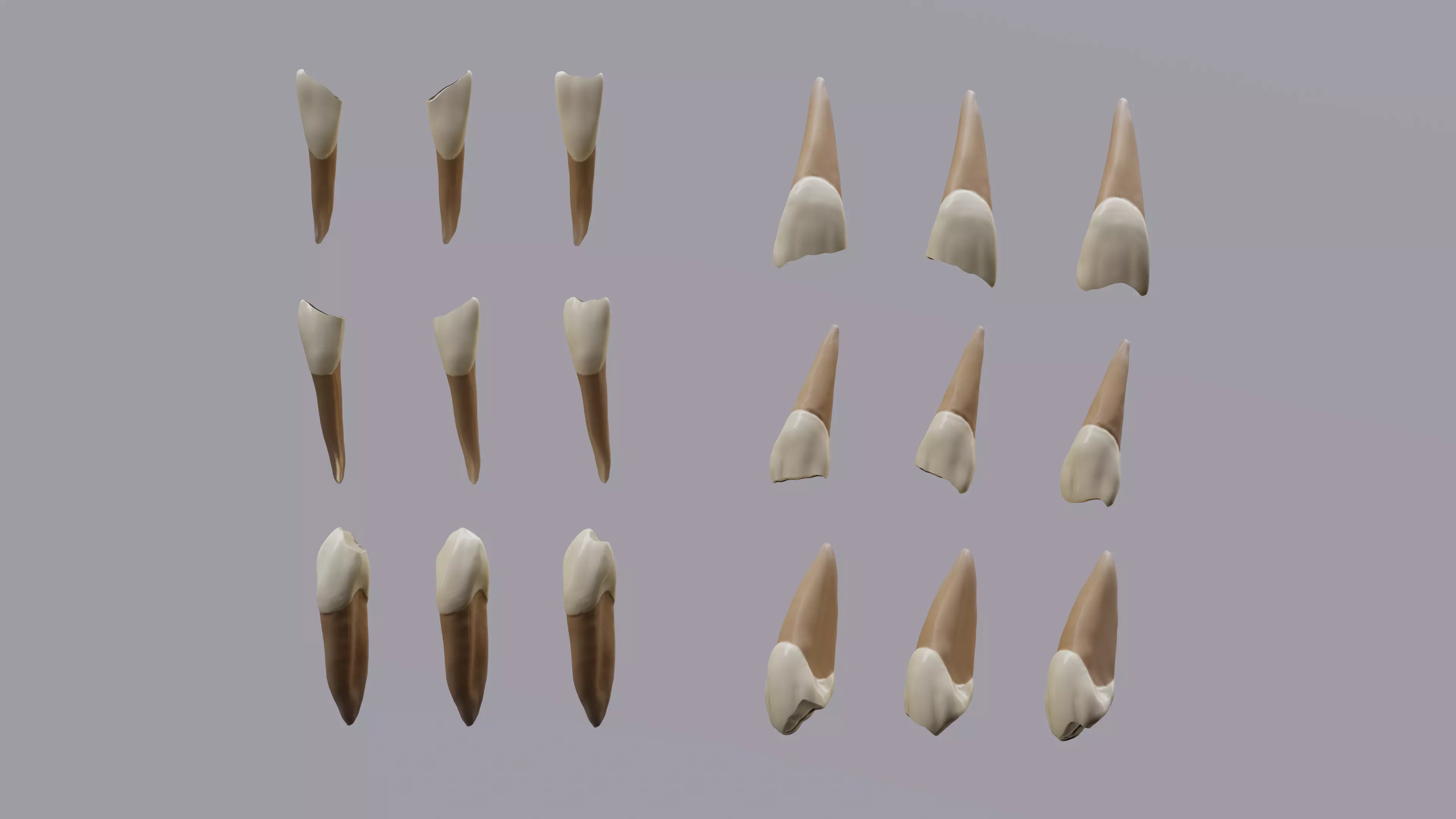 Permanent Teeth class 4 Caries 3D model_0