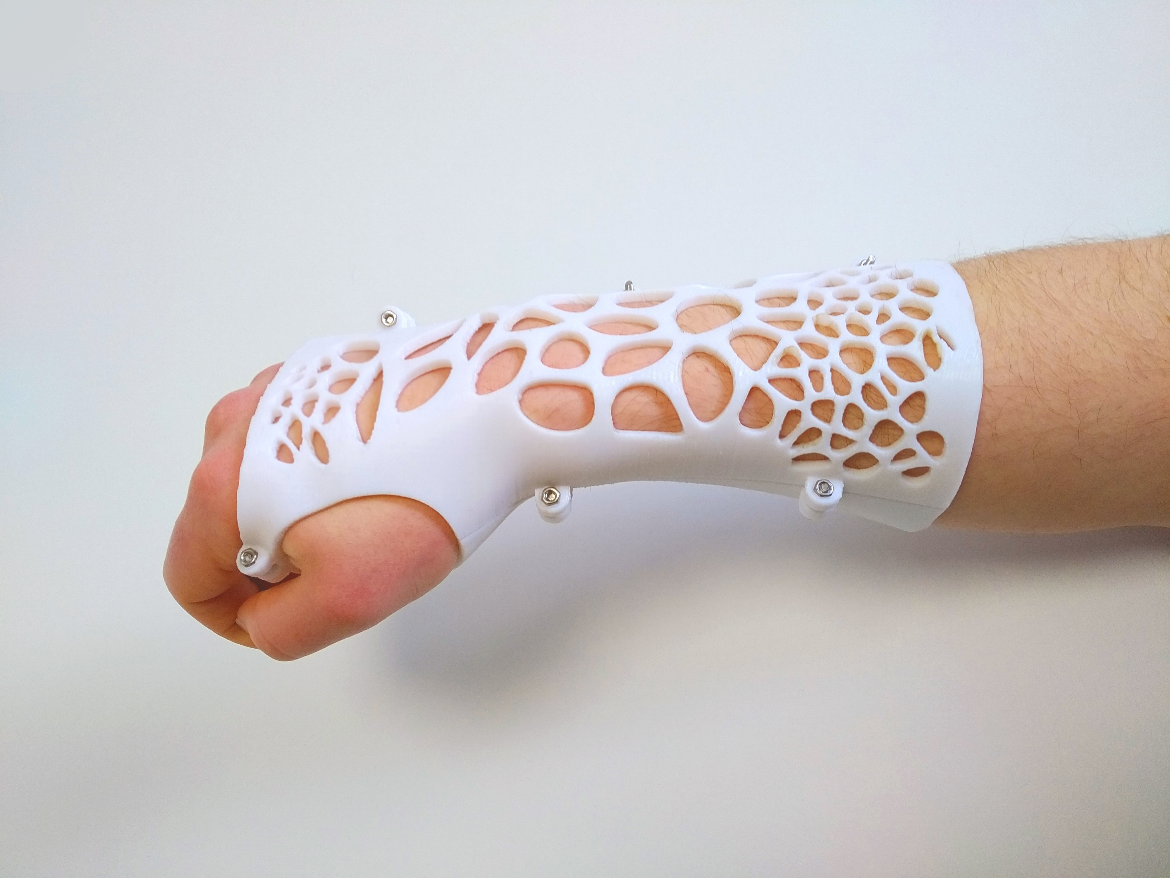 ARM SPLINT - 3D PRINT 3D print model_4