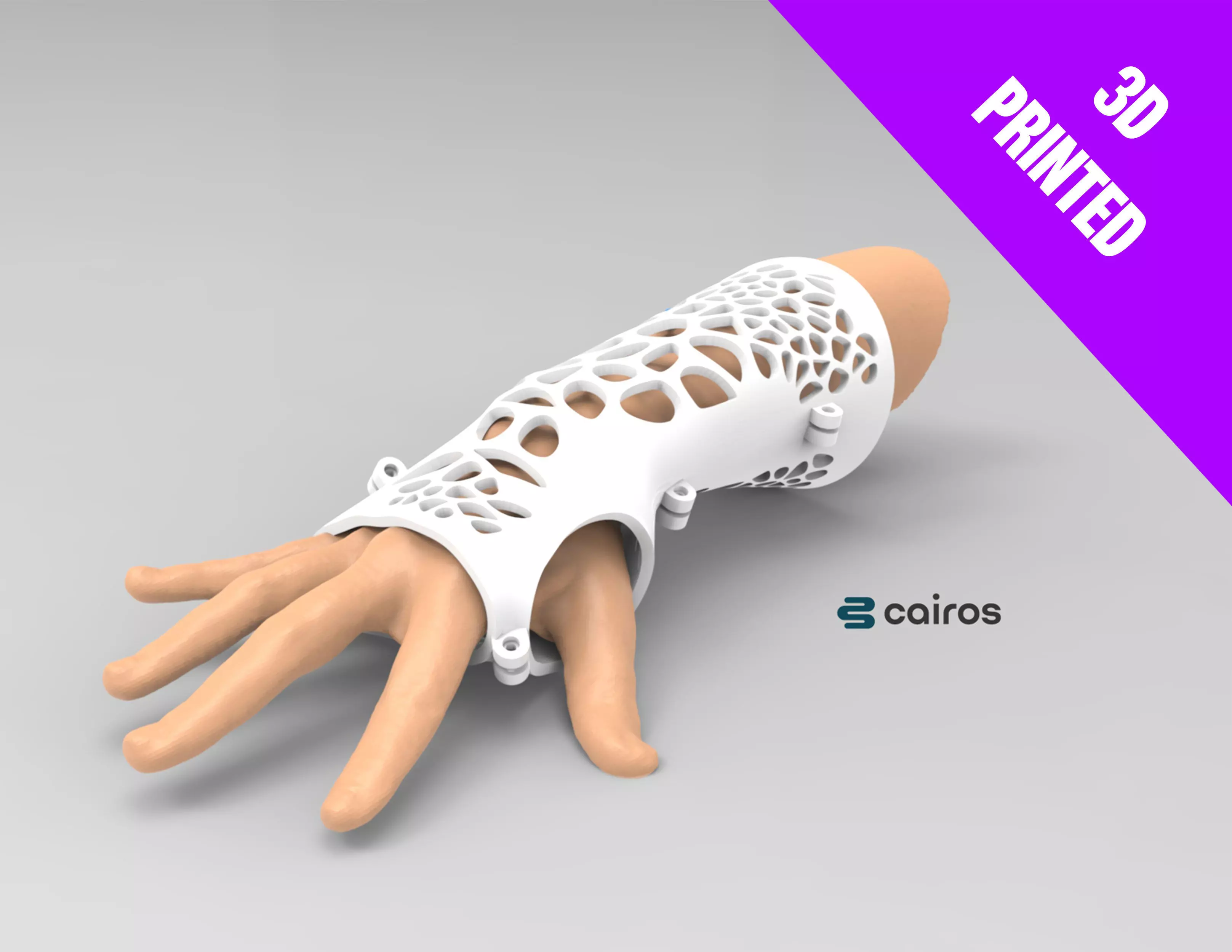 ARM SPLINT - 3D PRINT 3D print model_0