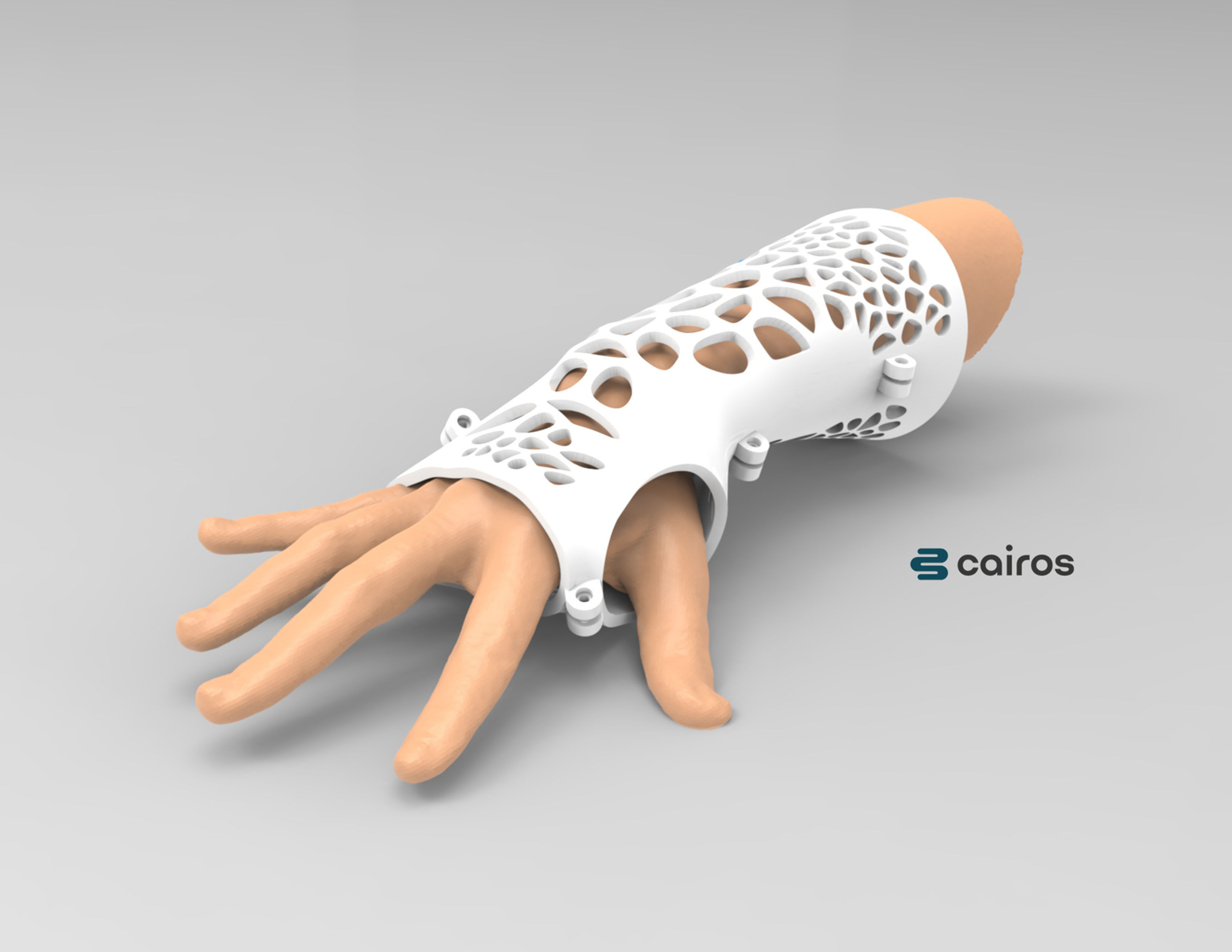 ARM SPLINT - 3D PRINT 3D print model_3