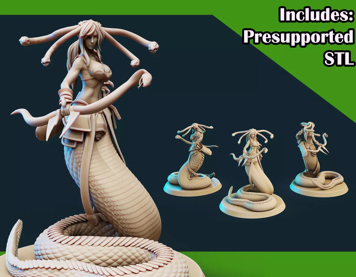 3D Printable Medusa Elite Longbow Pose 2 3D print model_0