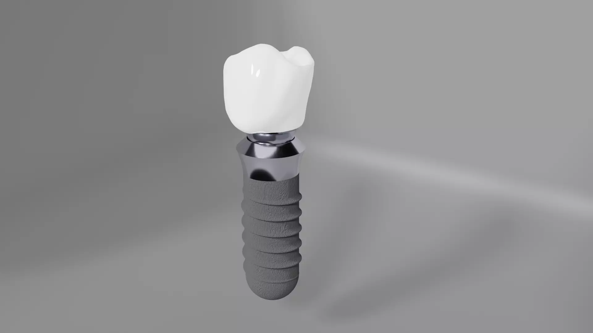 Dental implant crown restoration - High-res 3D model