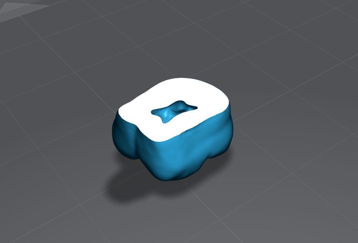 Permanent Teeth with Pulp Cavity 3D print model_14