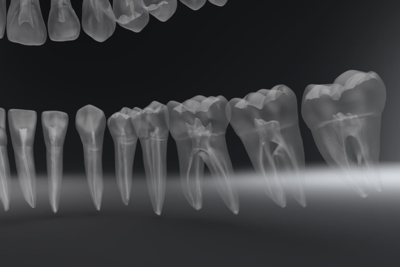 Permanent Teeth with Pulp Cavity 3D print model_5