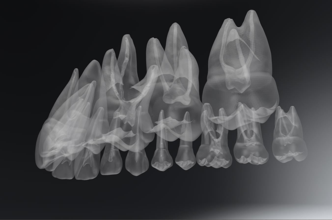 Permanent Teeth with Pulp Cavity 3D print model_9