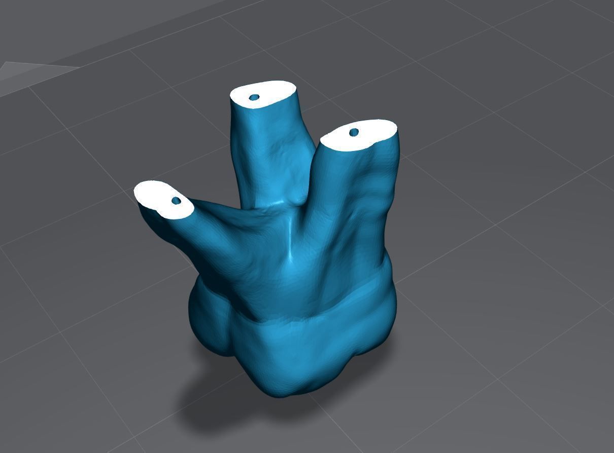 Permanent Teeth with Pulp Cavity 3D print model_12