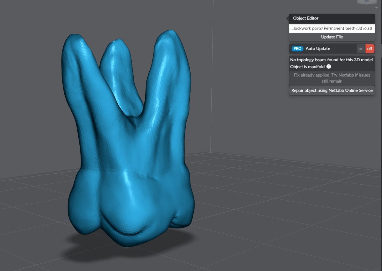 Permanent Teeth with Pulp Cavity 3D print model_11