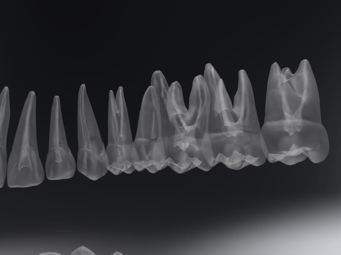 Permanent Teeth with Pulp Cavity 3D print model_4