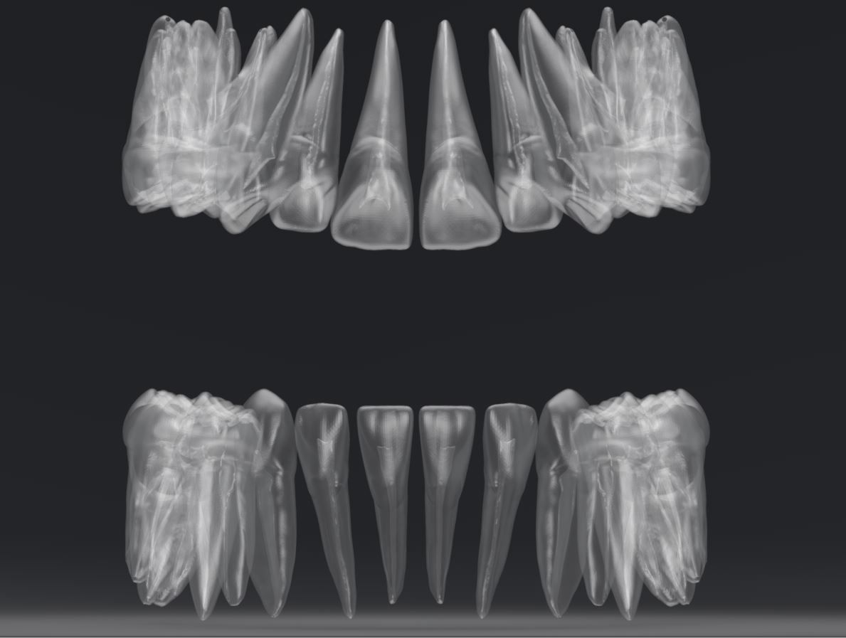 Permanent Teeth with Pulp Cavity 3D print model_1