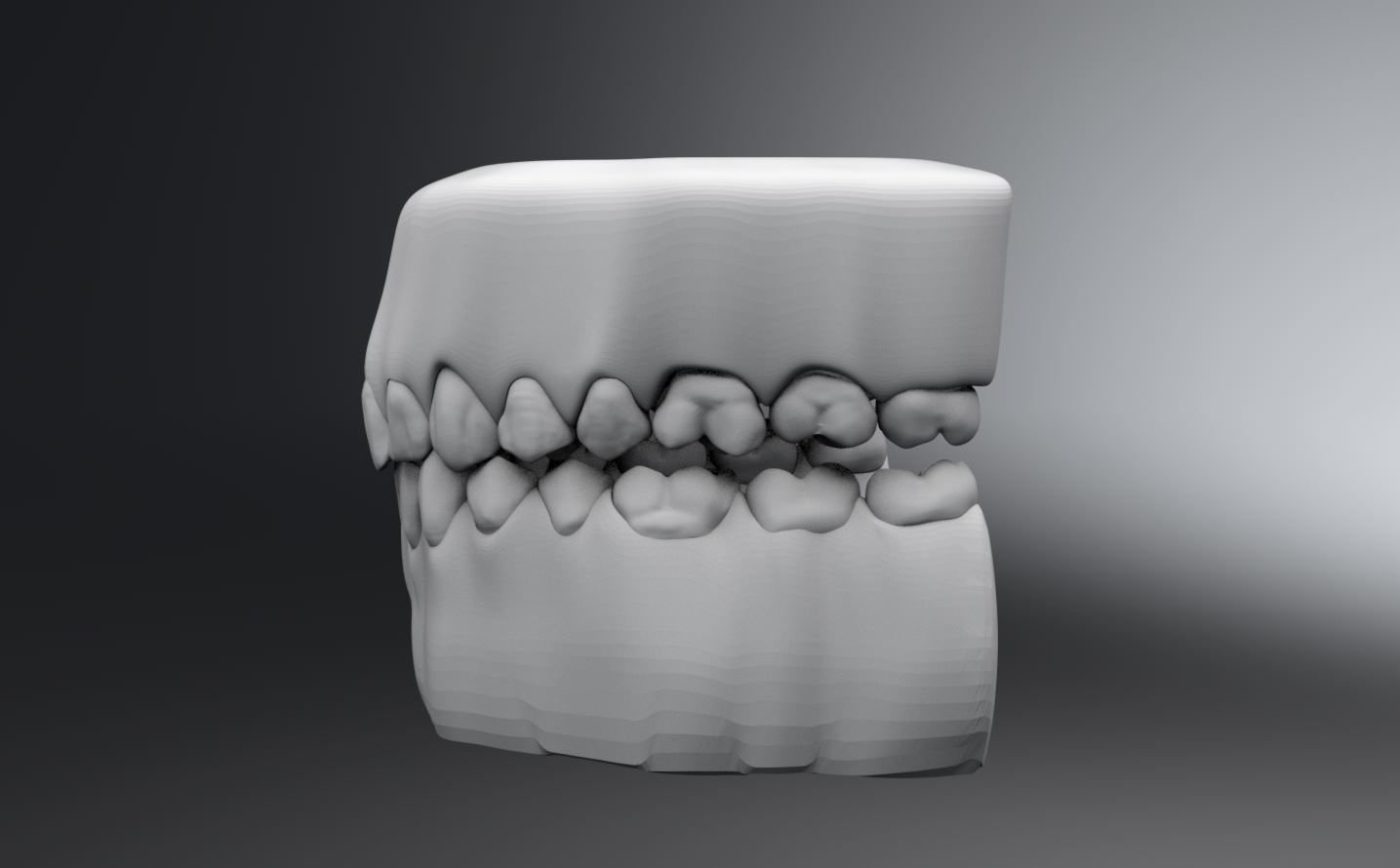 Permanent Teeth with Jaw 3D print model_3
