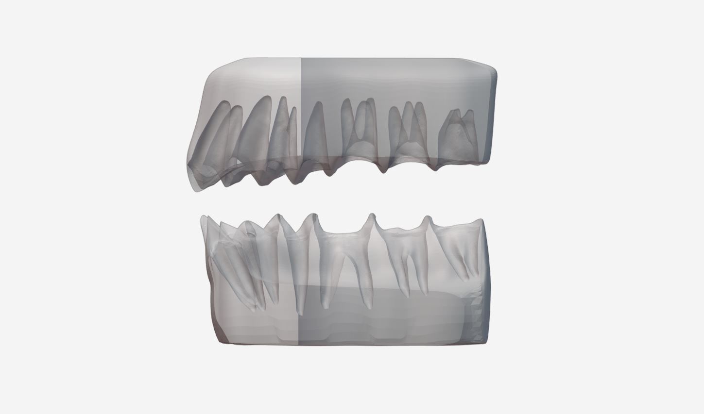Permanent Teeth with Jaw 3D print model_4