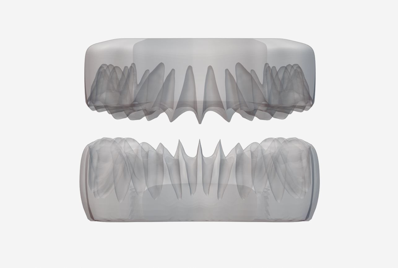 Permanent Teeth with Jaw 3D print model_2