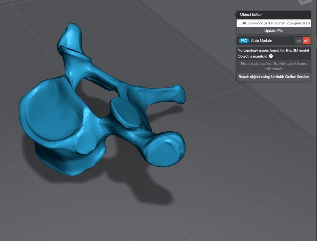 Human Spine Articulated 3D print model_8