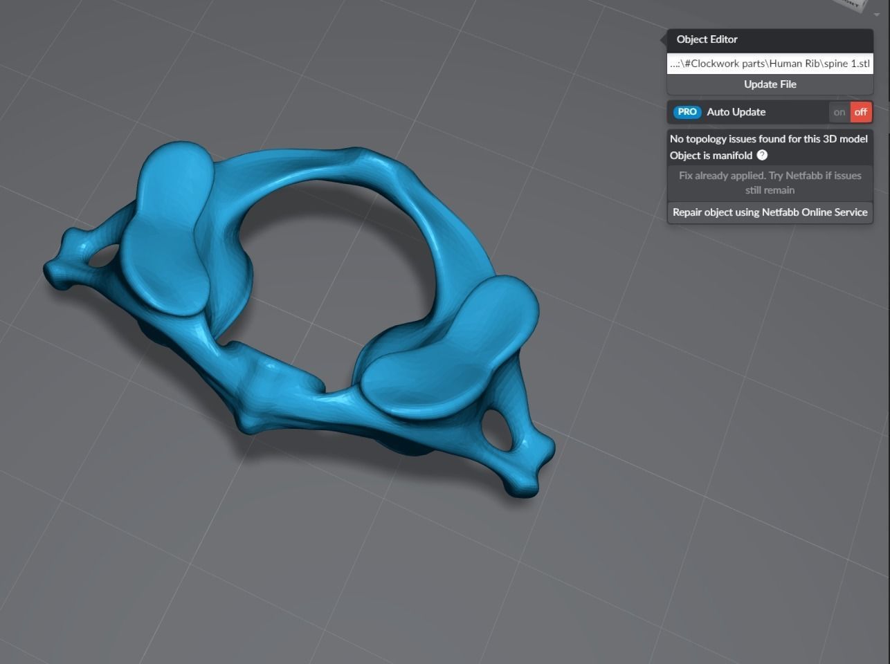 Human Spine Articulated 3D print model_5