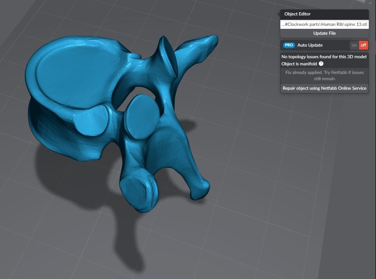 Human Spine Articulated 3D print model_9