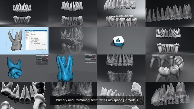 Primary and Permanent teeth with Pulp space 3D Model Collection