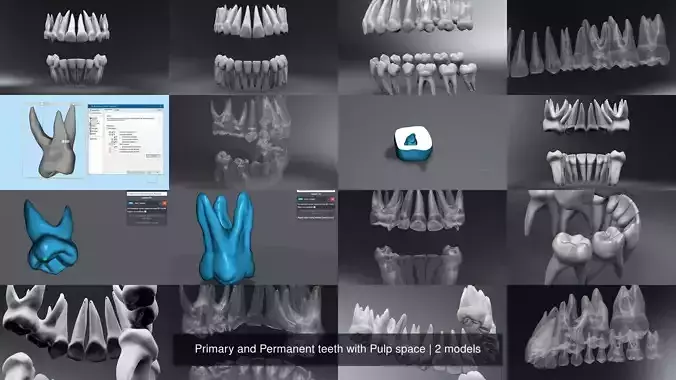 Primary and Permanent teeth with Pulp space 3D Model Collection