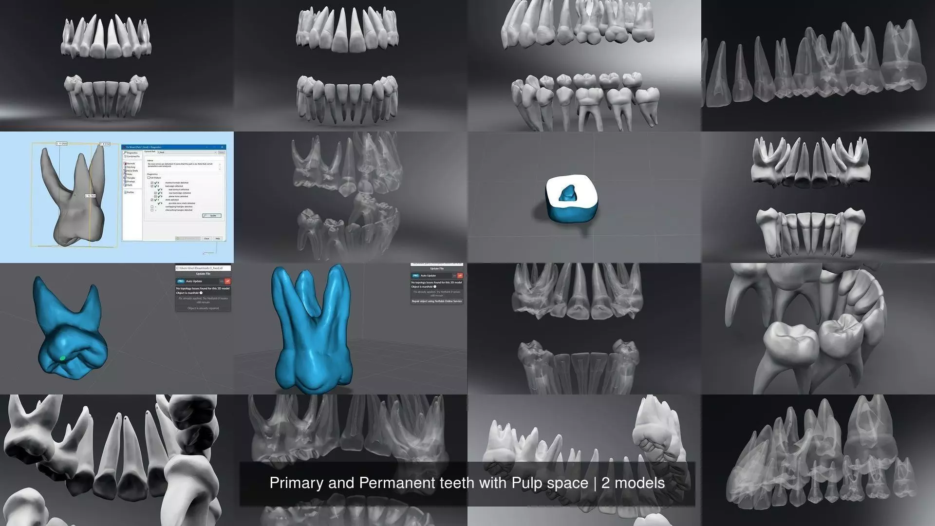 Primary and Permanent teeth with Pulp space 3D Model Collection_0