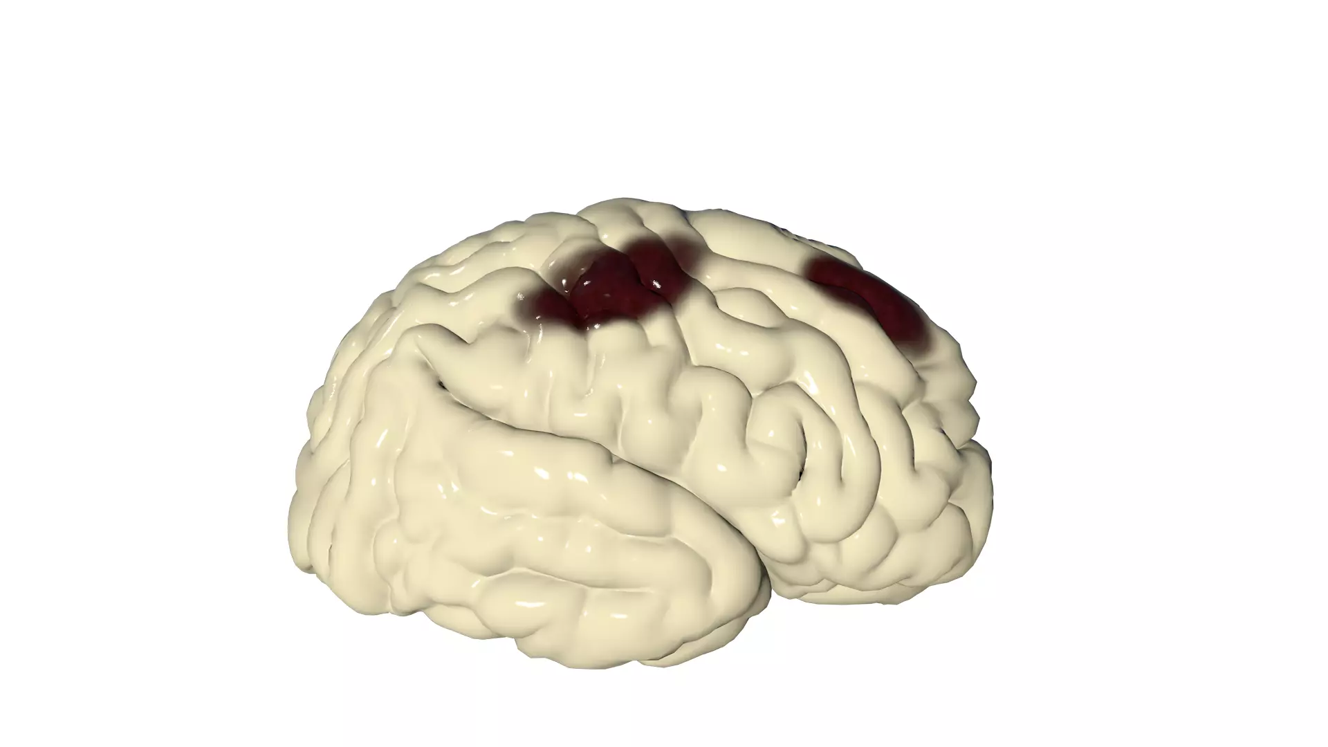 Injured Brain Low-poly 3D model_0