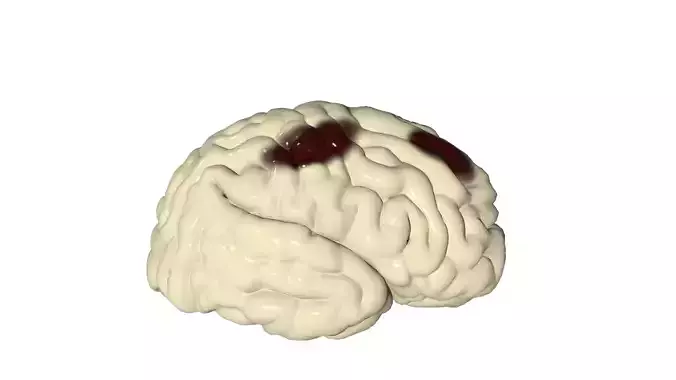 Injured Brain Low-poly 3D model