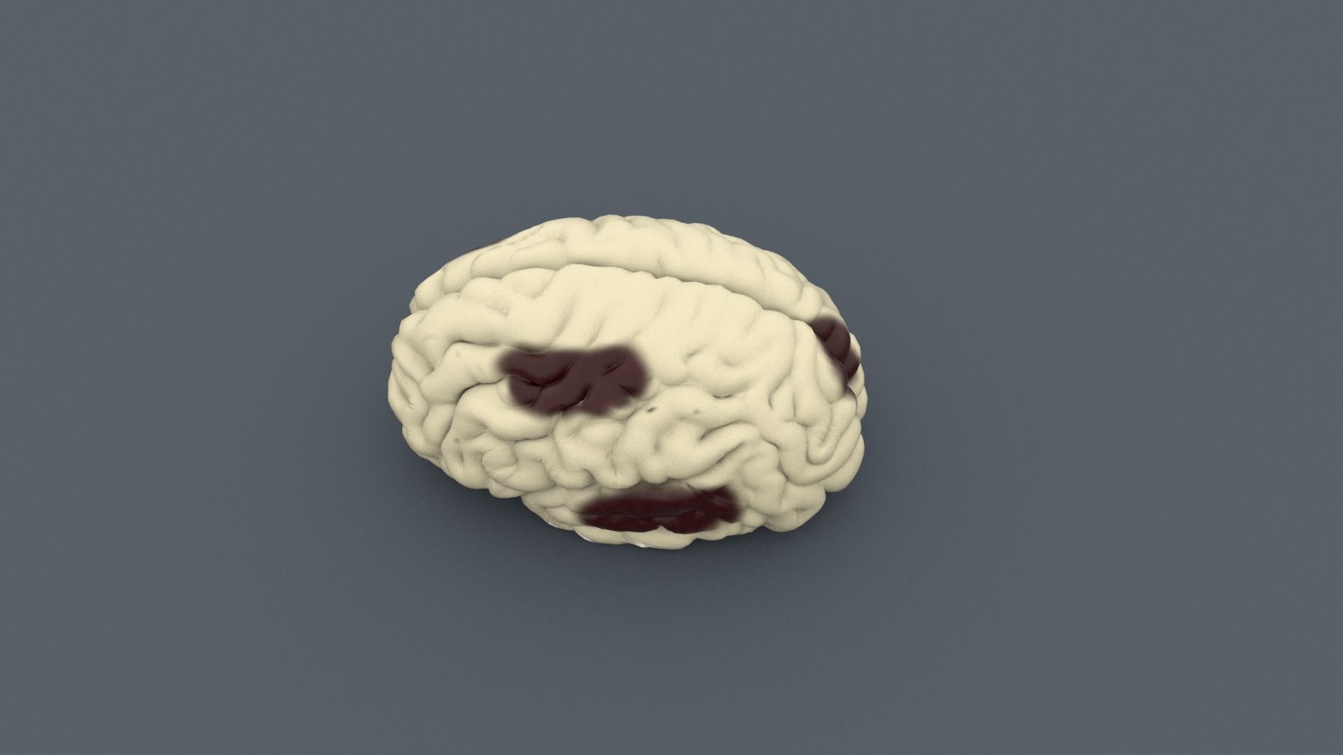 Injured Brain Low-poly 3D model_1