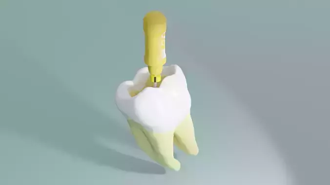 Molar and endodontic file