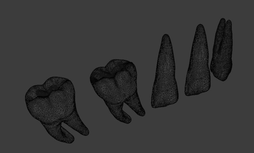 Dental restorations - Blacks Class I to V 3D model_10