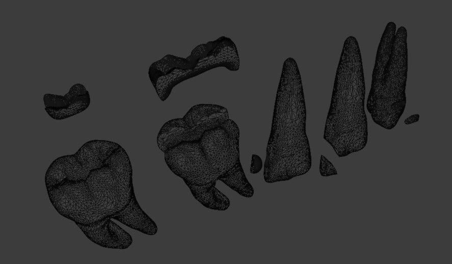 Dental restorations - Blacks Class I to V 3D model_9