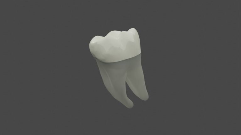 Endocrown restoration 3D model_1
