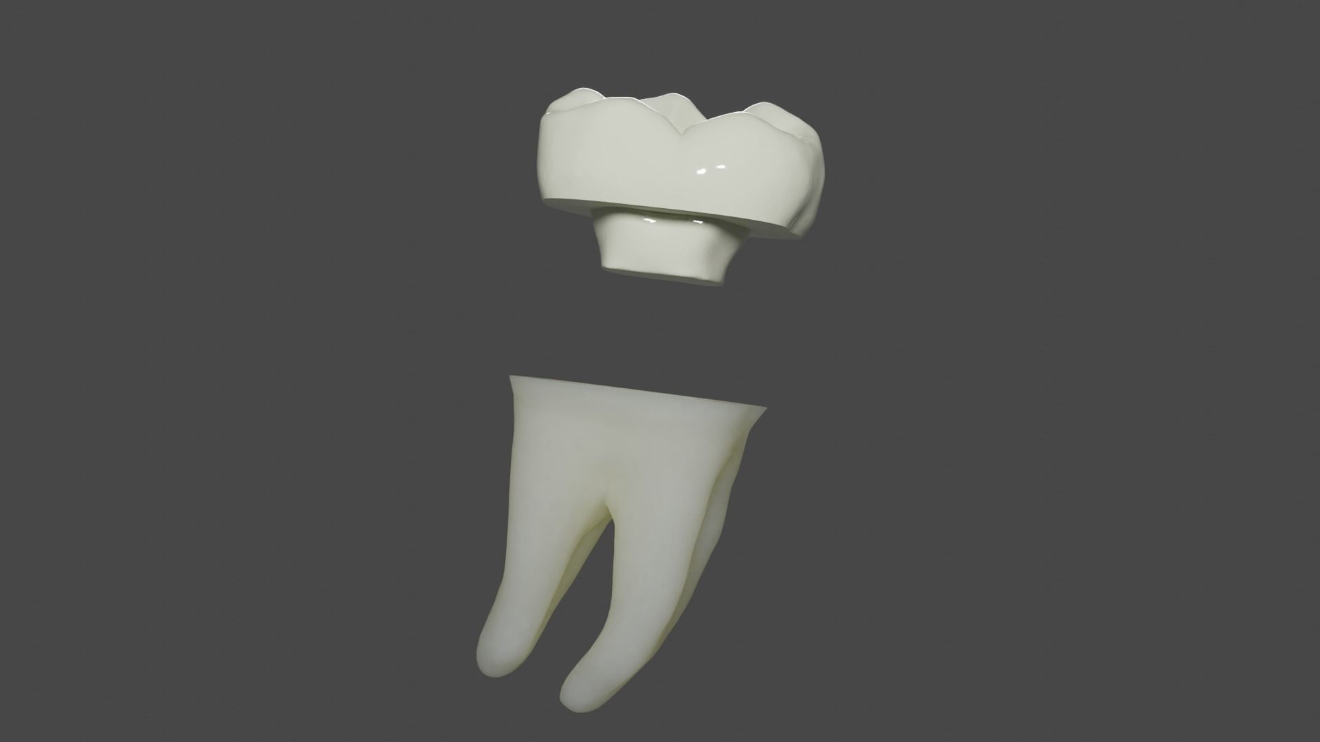Endocrown restoration 3D model_3