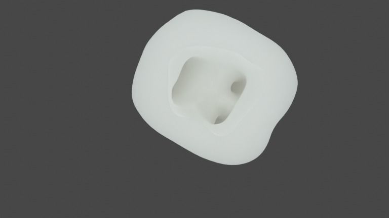 Endocrown restoration 3D model_2