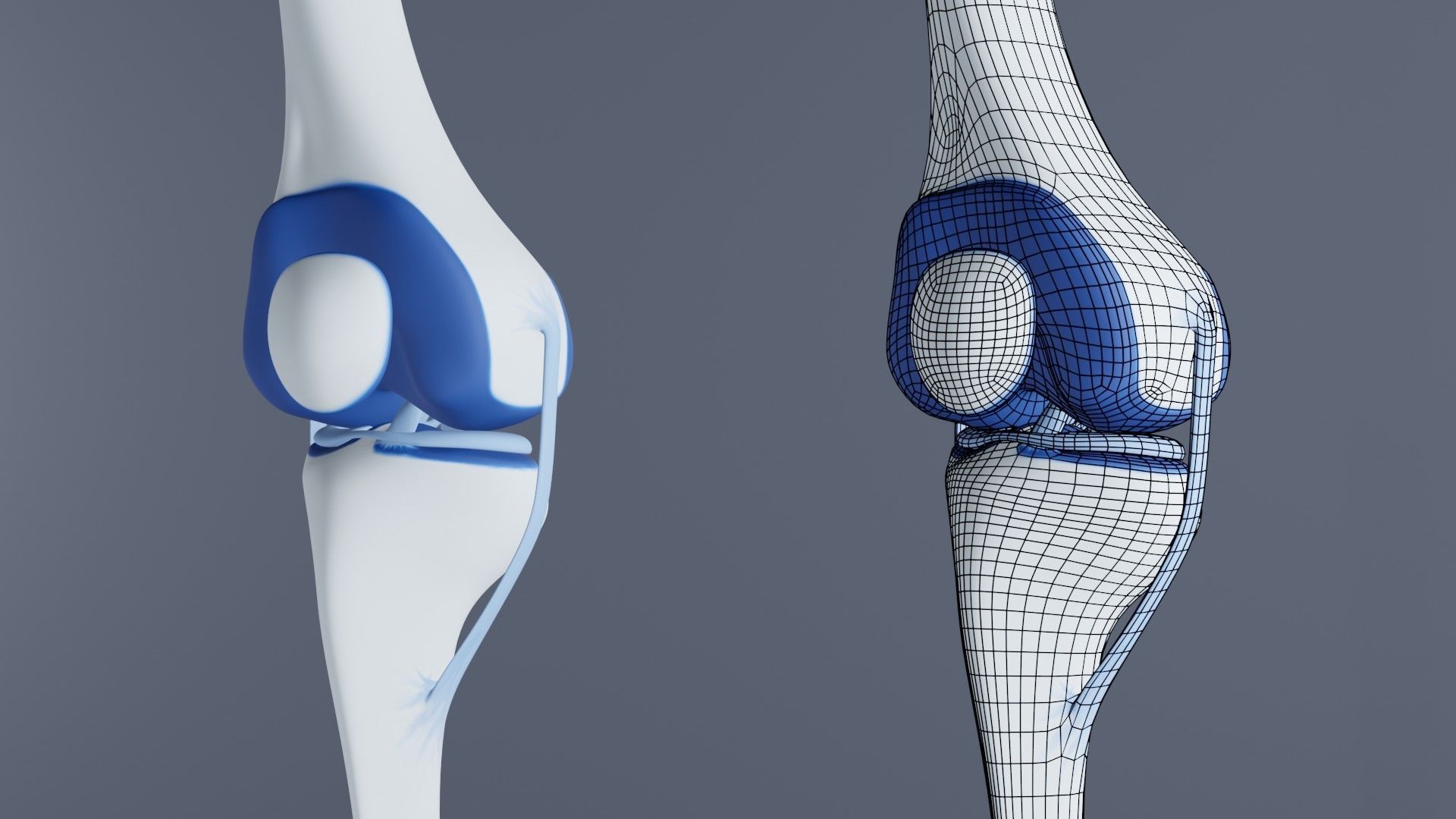 Knee Joint 3D model_9
