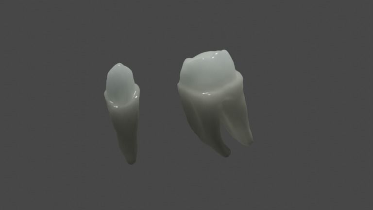 Fixed partial denture - Prosthodontics 3D model_2